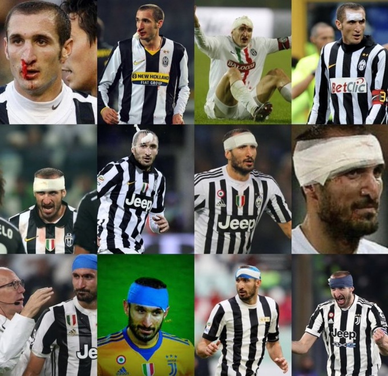 chiellini_blood.jpg